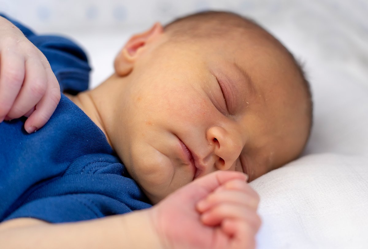 Jaundice in Newborns